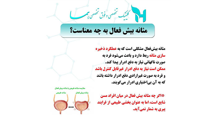 مثانه بیش فعال به چه معناست ؟