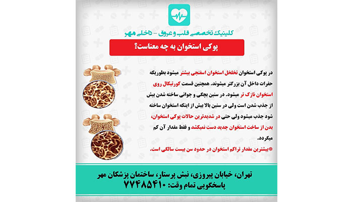 پوکی استخوان به چه معناست ؟