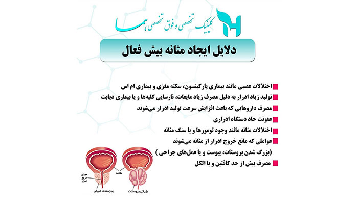 دلایل ایجاد مثانه بیش فعال
